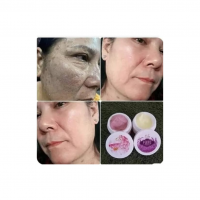 Freckle removal cream, Dark spot remover, Blemish eraser, Skin tone corrector, Spot treatment solution, Pigmentation reducing cream, Skin blemish remover, Complexion enhancer, Skin imperfection corrector, Whitening cream, Even skin tone solution, Skin discoloration eraser, Scar lightening cream, Beauty spot remover, Skin flaw corrector, Melasma treatment cream, Hyperpigmentation eraser, Skin brightening solution, Acne mark remover, Skin renewal cream, Dark spot corrector, Skin clarifying solution, Blemish treatment cream, Uneven skin tone corrector, Age spot remover, Skin depigmentation cream, Pimple scar eraser, Skin complexion enhancer, Melanin reducing cream, Flawless skin solution, Scar fading cream, Skin perfection solution, Spot fading cream, Skin rejuvenation solution, Discoloration corrector, Pimple blemish remover, Brightening and clarifying cream, Blemish and spot corrector, Skin imperfection remover, Whitening and brightening cream, Skin tone perfecting solution, Scar diminishing cream, Mark and blemish eraser, Pigment correcting cream, Complexion correcting solution, Flawless complexion cream, Skin renewal solution, Dark mark remover, Skin clarifying cream, Dark blemish corrector, Pigment-reducing solution, Acne scar fading cream, Skin revitalization solution, Spot and blemish eraser, Skin restoration cream, Melanin reducing solution, Blemish and scar remover, Skin radiance cream, Age spot corrector, Skin depigmentation solution, Blemish and dark spot eraser, Complexion enhancement cream, Scar and mark removal solution, Hyperpigmentation correcting cream, Skin renewal and rejuvenation solution, Spot lightening cream, Skin brightening and clarifying solution, Pigment correction cream, Flawless complexion solution, Scar reduction cream, Blemish removal solution, Uneven skin tone corrector, Age spot eraser, Skin depigmentation cream, Pimple scar fading solution, Dark spot and blemish remover, Skin tone perfecting cream, Scar and mark eraser, Pigment-reducing solution, Acne scar removal cream, Skin radiance solution, Dark blemish corrector, Pigment correction cream, Skin imperfection eraser, Complexion enhancement solution, Scar and blemish remover, Melanin reducing cream, Blemish and dark spot eraser, Complexion correction cream, Scar and mark removal solution, Hyperpigmentation correcting cream, Skin renewal and rejuvenation solution, Spot lightening cream, Skin brightening and clarifying solution, Pigment correction cream, Flawless complexion solution, Scar reduction cream, Blemish removal solution, Uneven skin tone corrector, Age spot eraser.